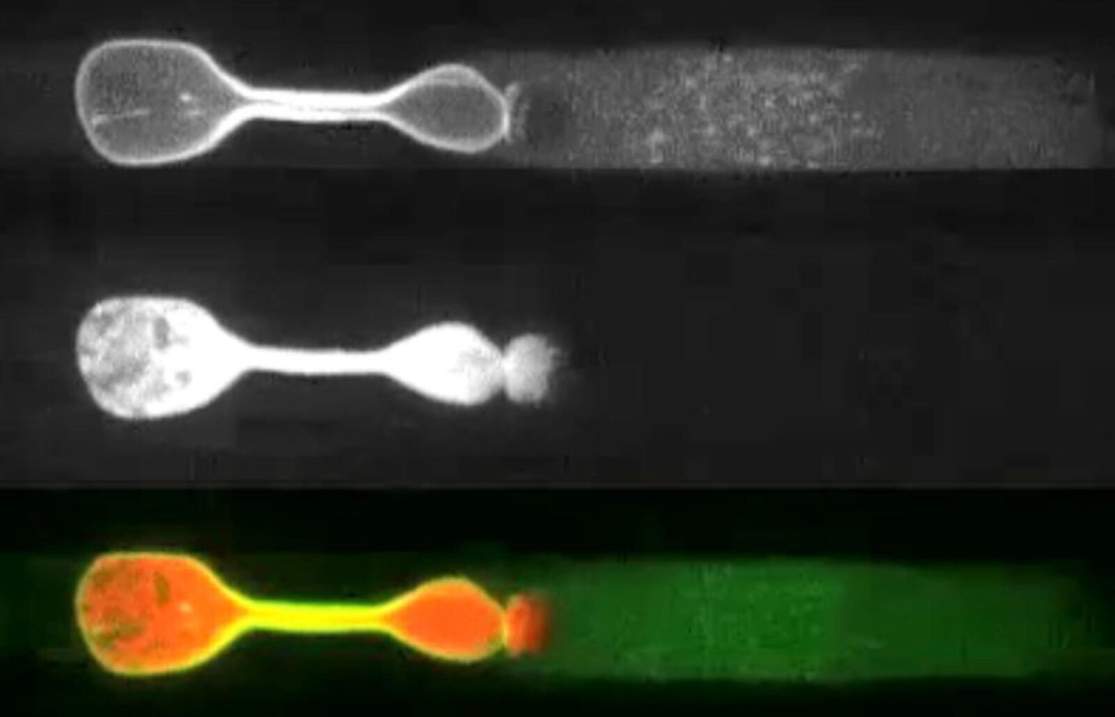 Nuclear fragility drives breast tumor cell invasion Master BME